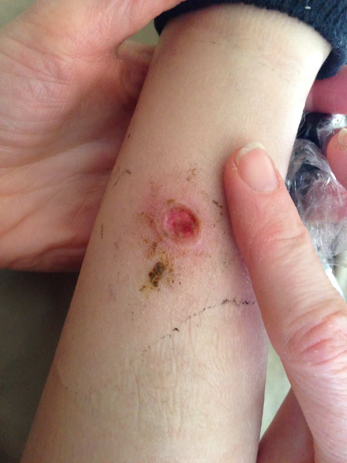 Brown Recluse Spider Infestation: Idaho'S Growing Problem? - 0qf8z80